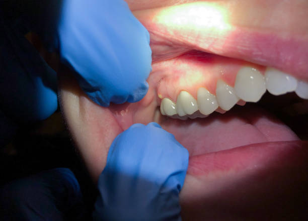 Best Emergency Dentist for Special Needs Patients in Farmersburg, IN
